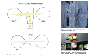 arclight-diagram-device-and-mobile-phone-attachment