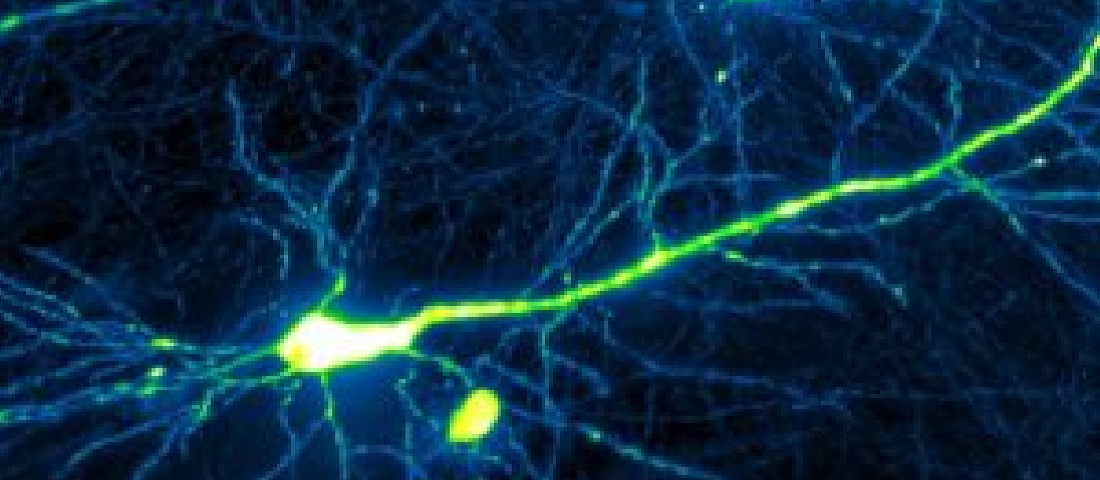 20210625-Arclight Biophotonics Image