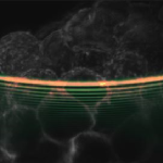 Light Sheet Microscopy Image