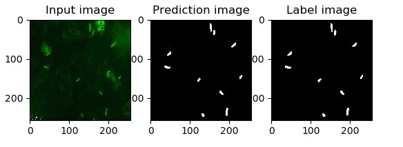 Image Analysis for TB Diagnosis