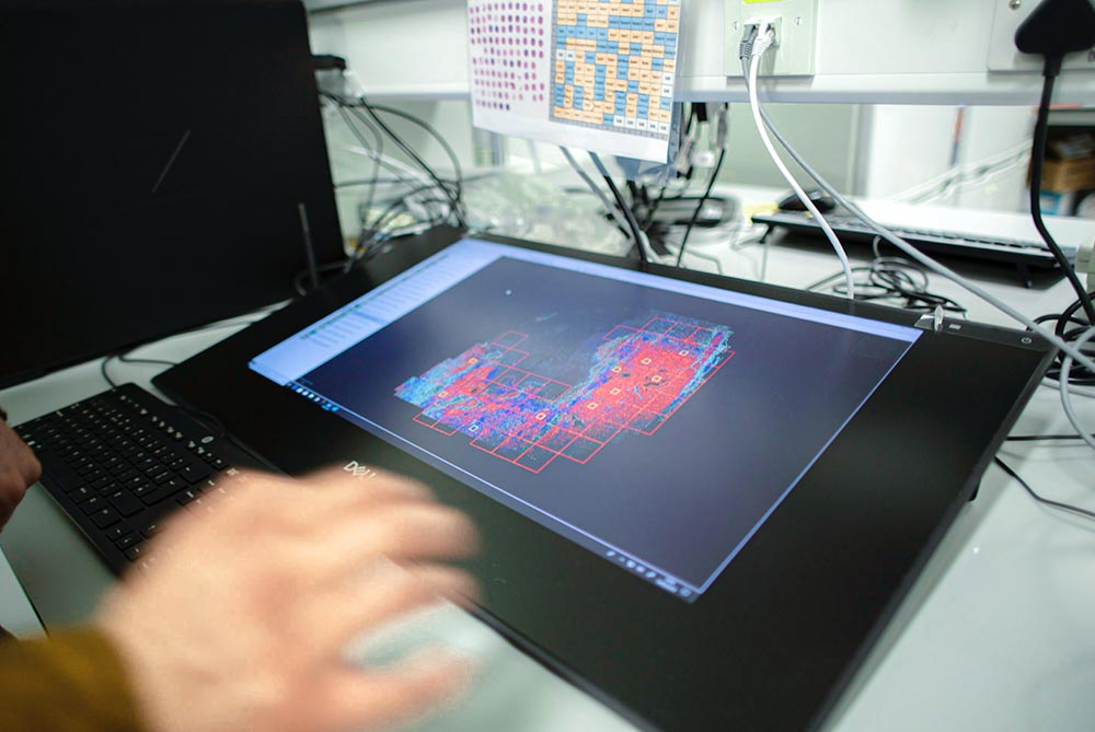 gaze tracking technology